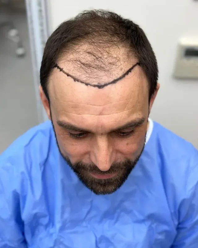 ÖNCESİ
