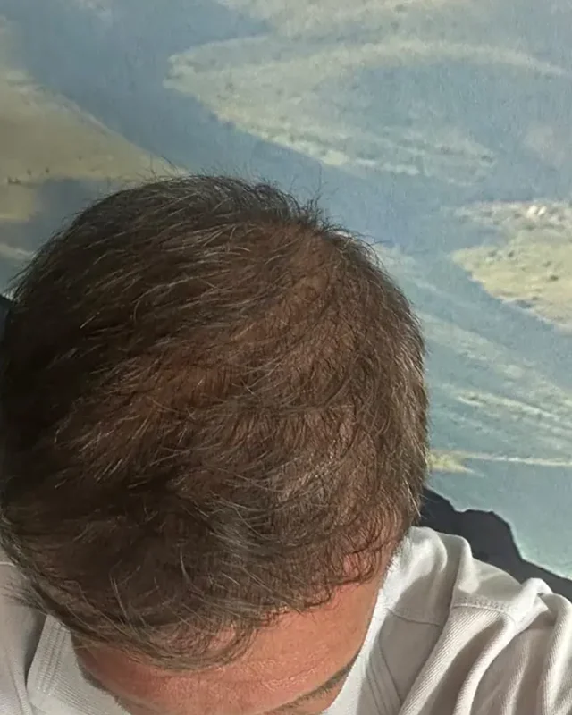 SONRASI