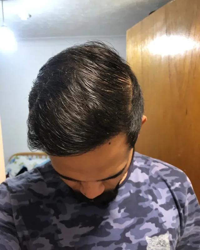 SONRASI