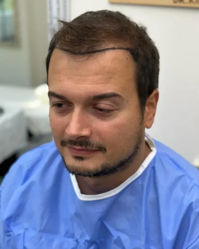 ÖNCESİ