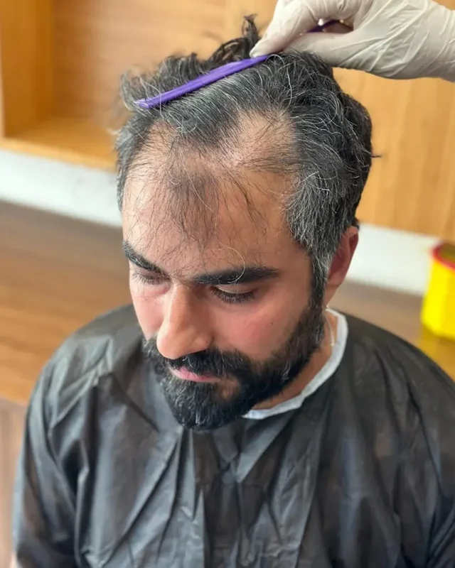 ÖNCESİ