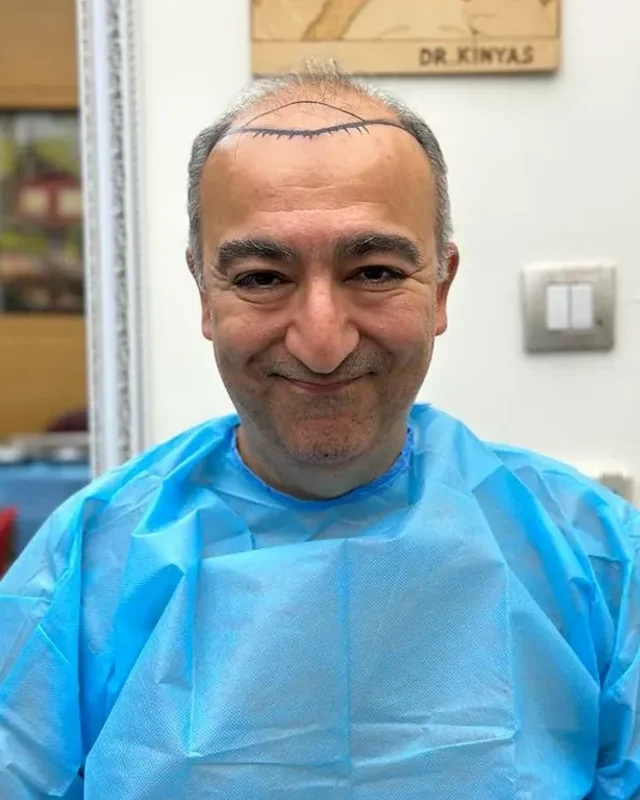 ÖNCESİ