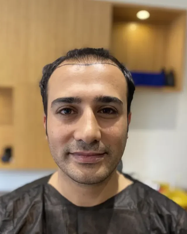ÖNCESİ