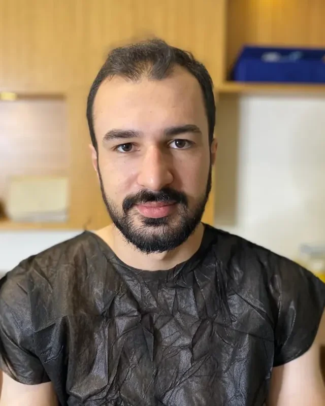 ÖNCESİ