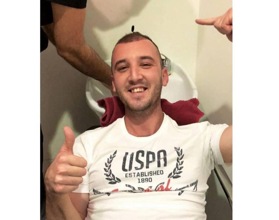ÖNCESİ - SONRASI