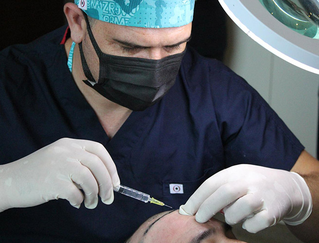 Hair Transplant
