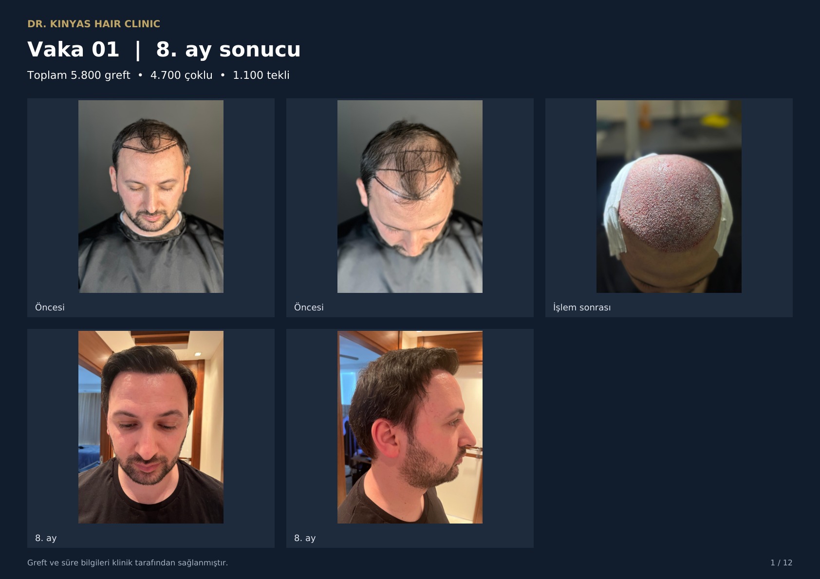 5800 GREFT - 8. AY SONUCU