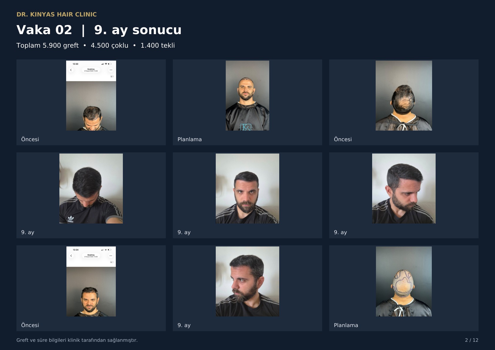 5900 GREFT - 9. AY SONUCU