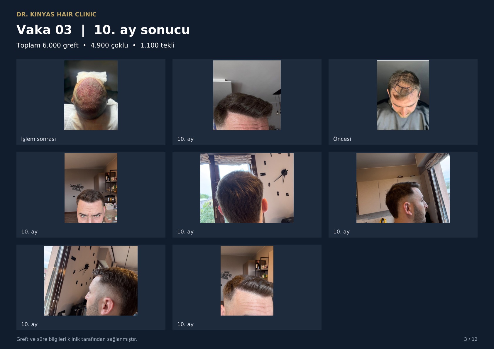 6000 GREFT - 10. AY SONUCU