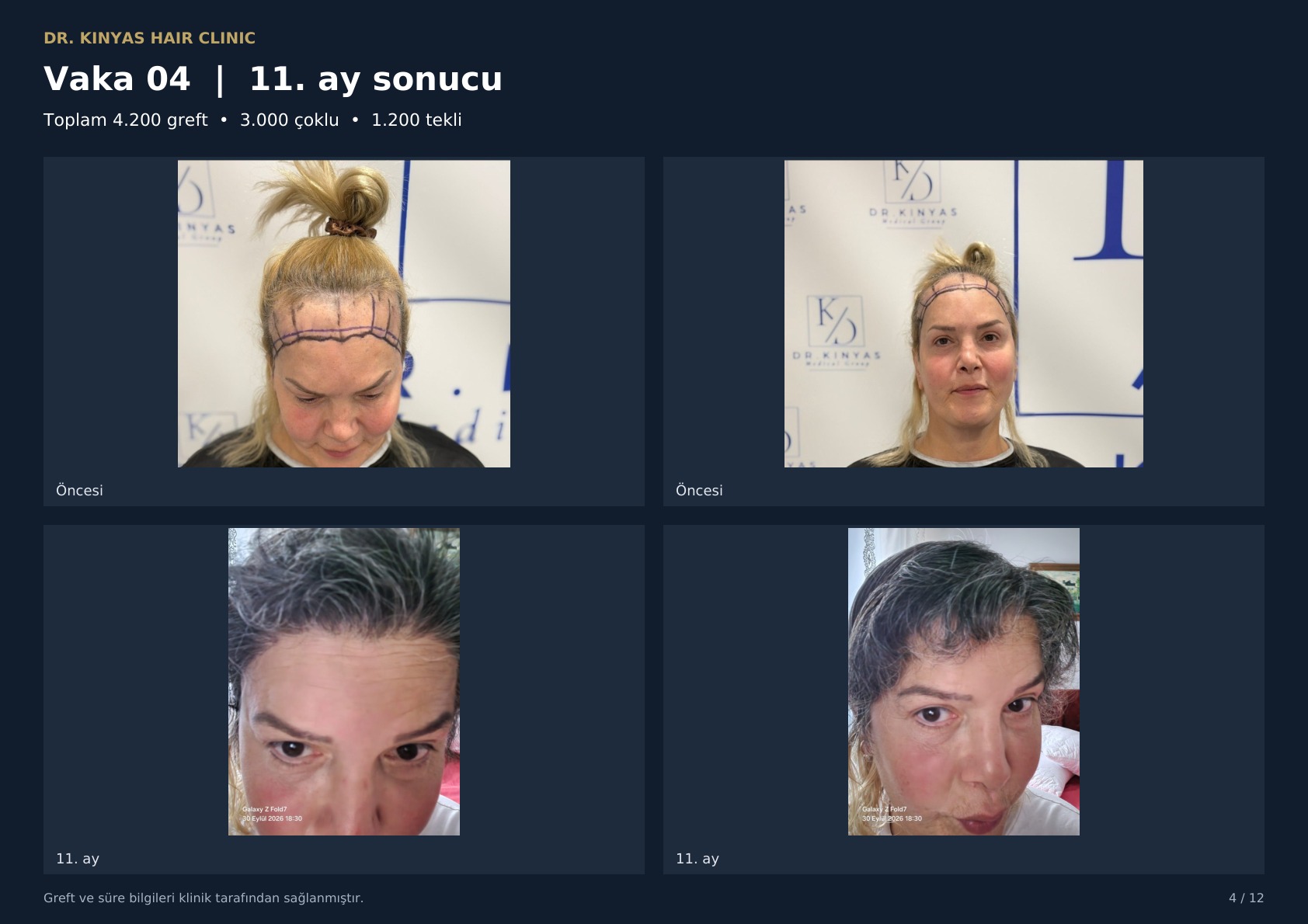 4200 GREFT - 11. AY SONUCU