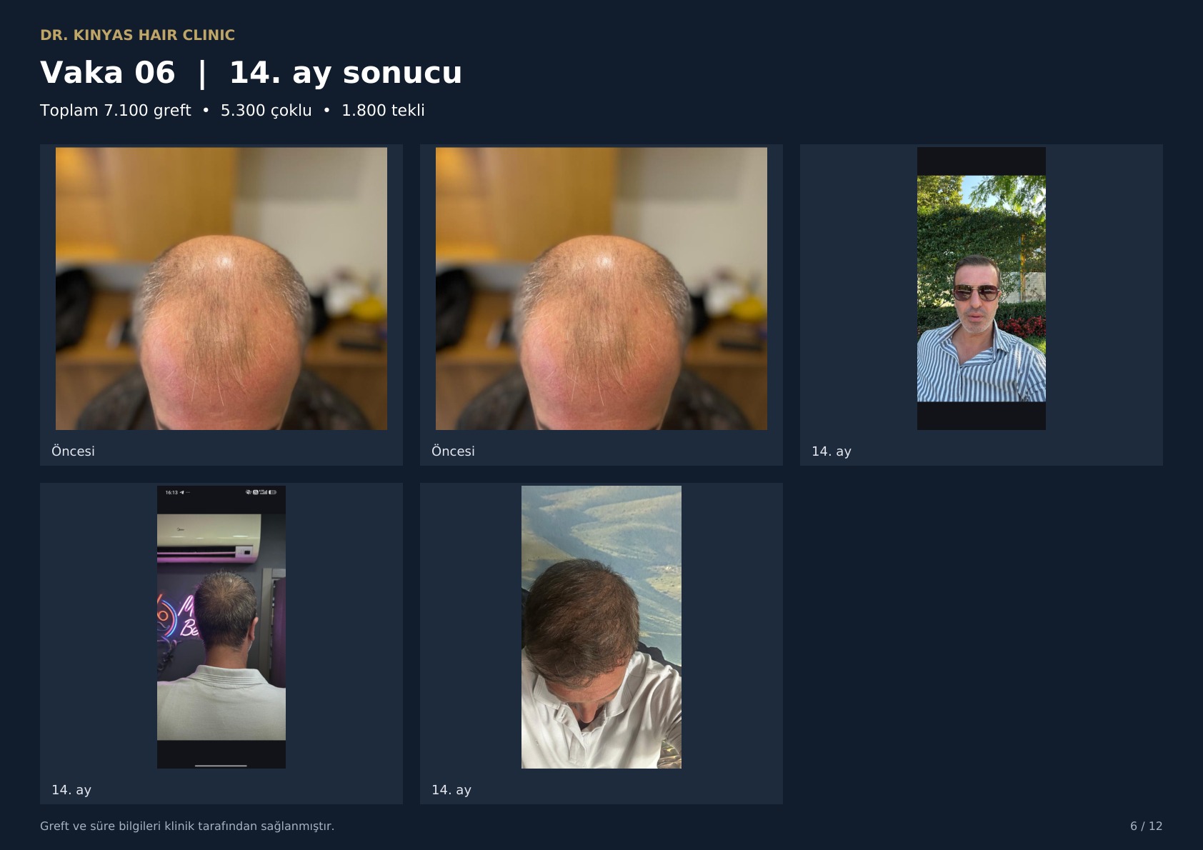 7100 GREFT - 14. AY SONUCU
