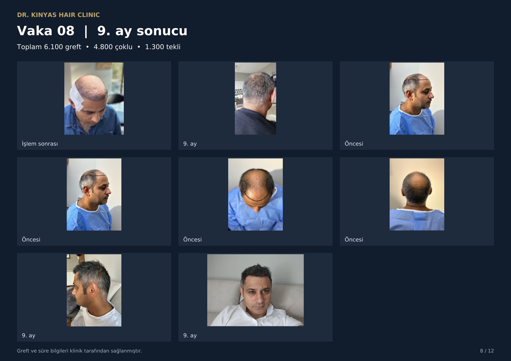 6100 GREFT - 9. AY SONUCU