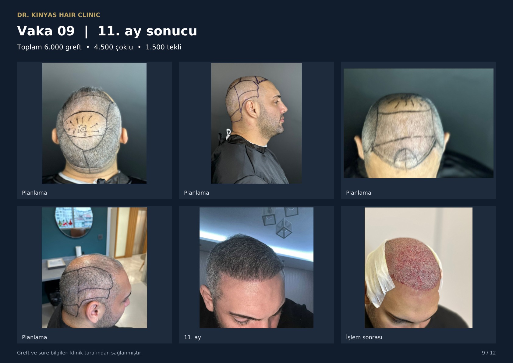 6000 GREFT - 11. AY SONUCU