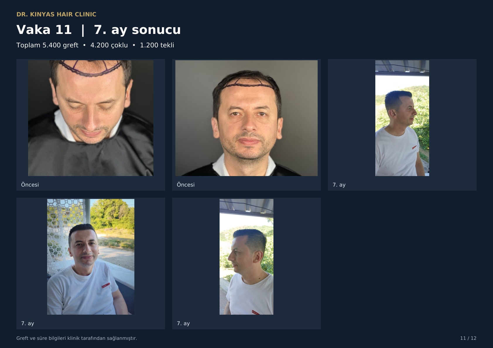 5400 GREFT - 7. AY SONUCU