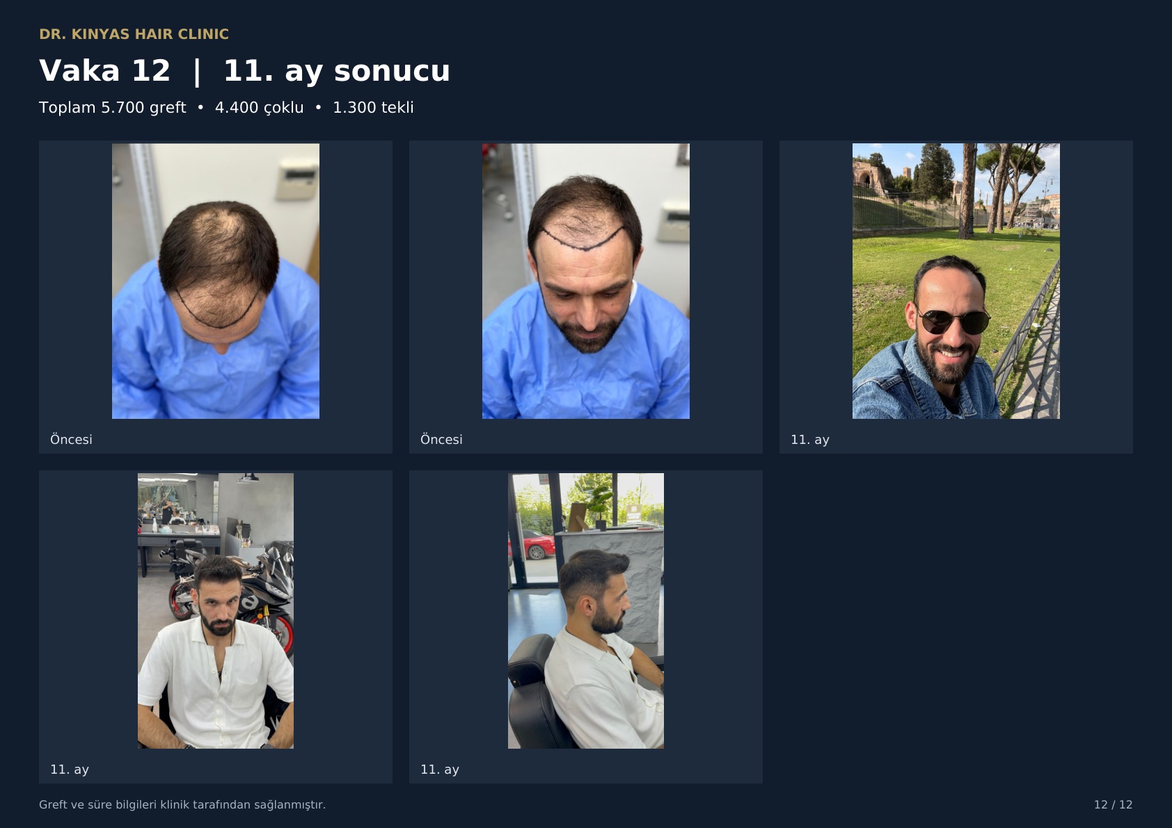 5700 GREFT - 11. AY SONUCU