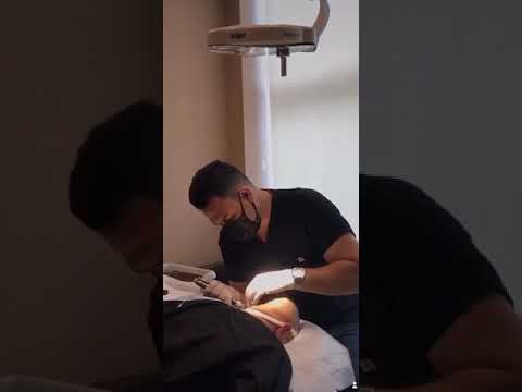 Dr. Kinyas ile Saç Ekimi Günü