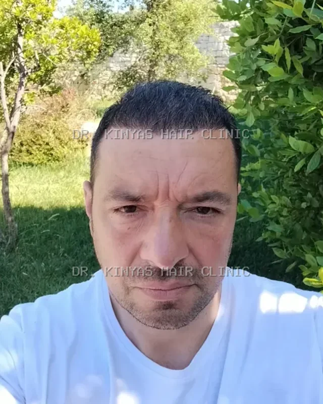 DOPO