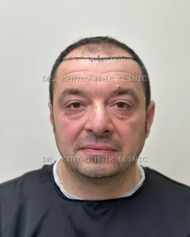 PRIMA