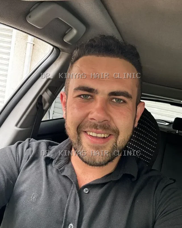DOPO