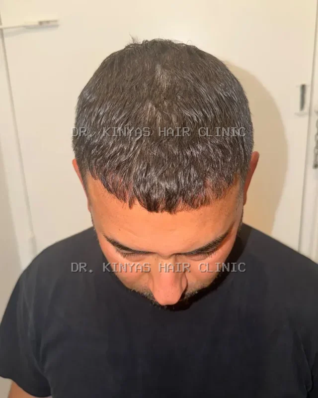 DOPO