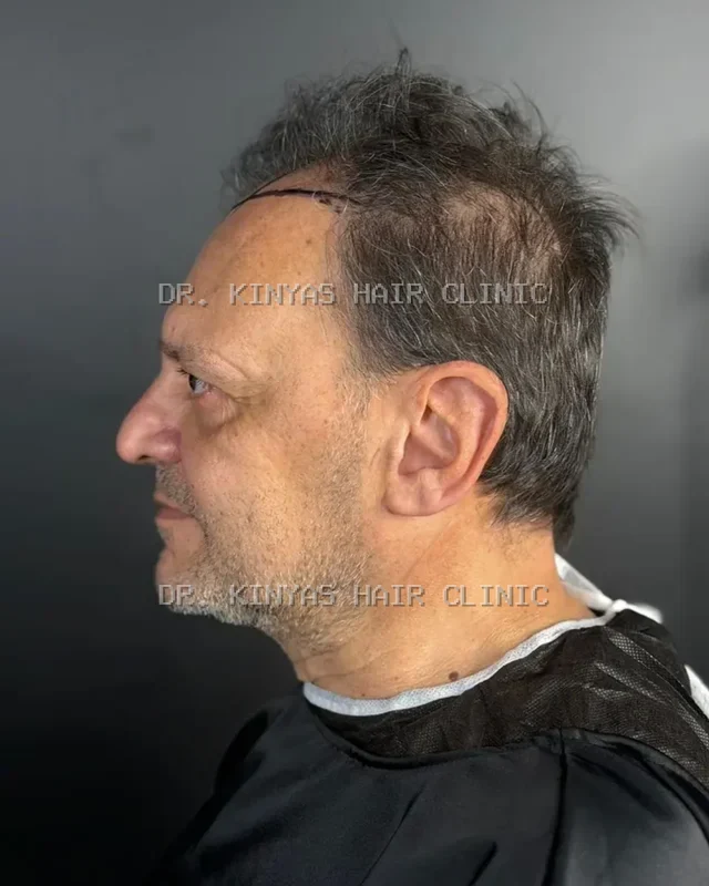 PRIMA