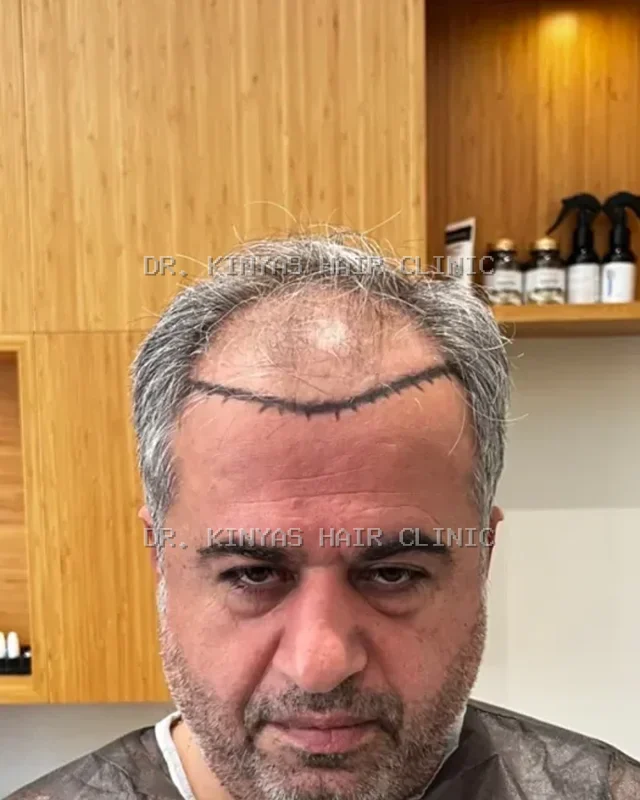 PRIMA