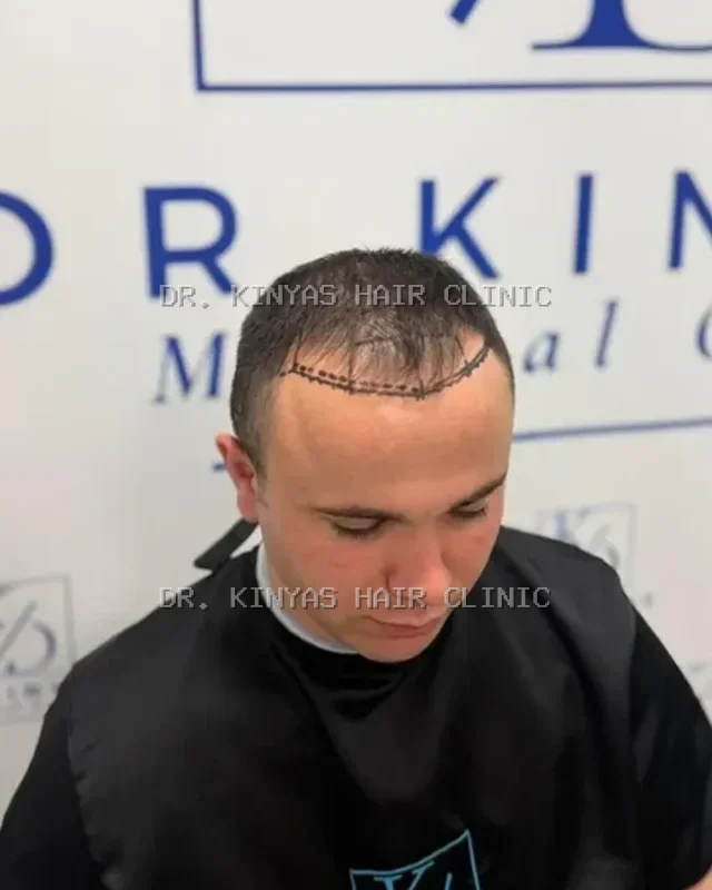 PRIMA