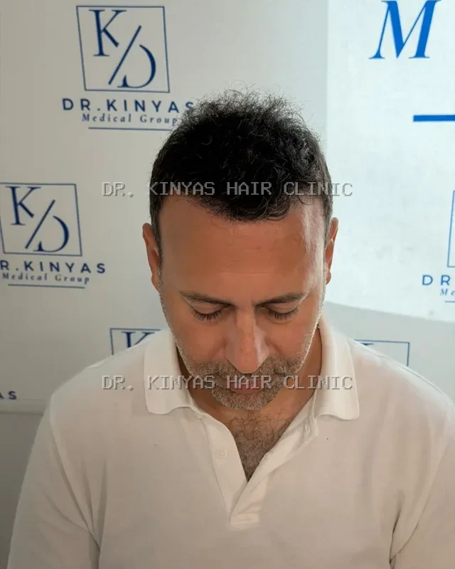 DOPO