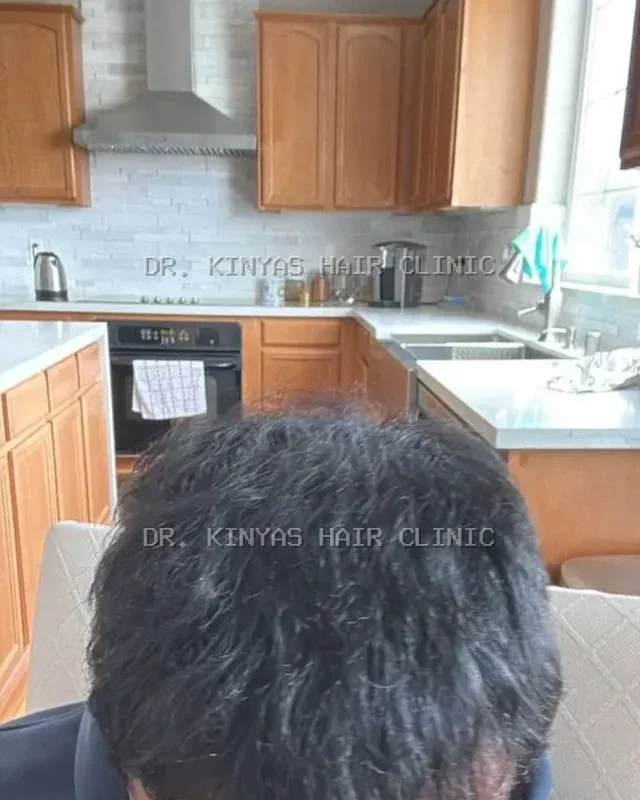 DOPO