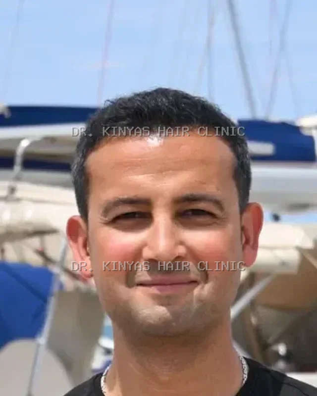DOPO