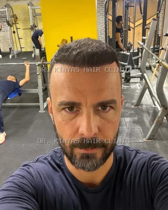 DOPO