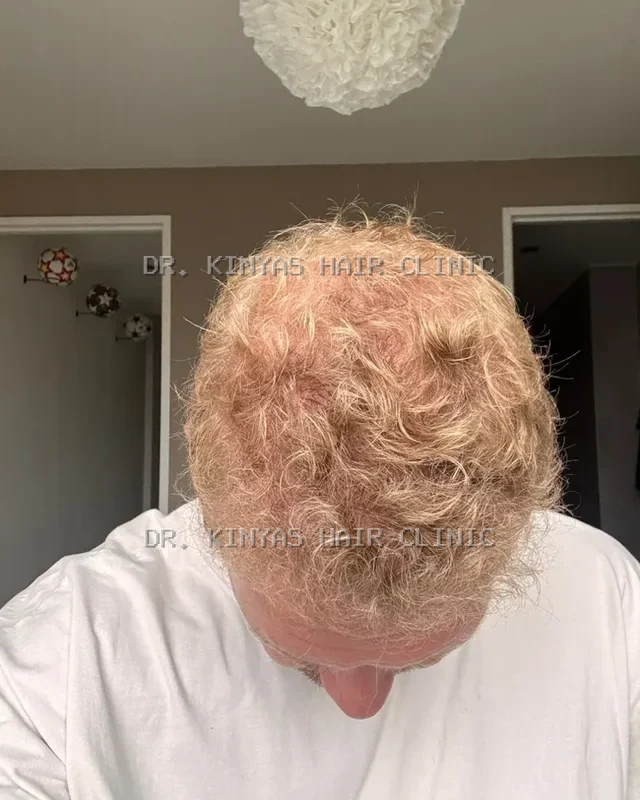 DOPO