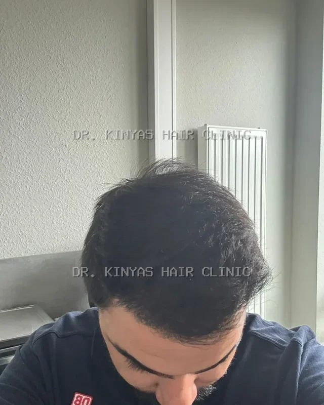 DOPO