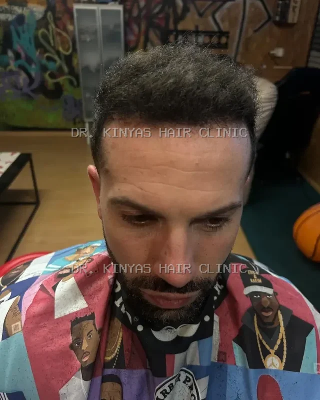 DOPO
