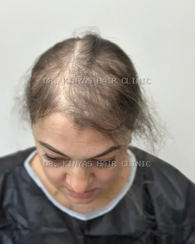 PRIMA