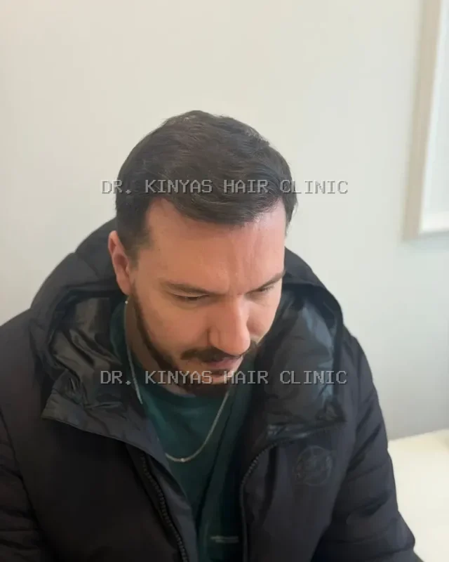 DOPO
