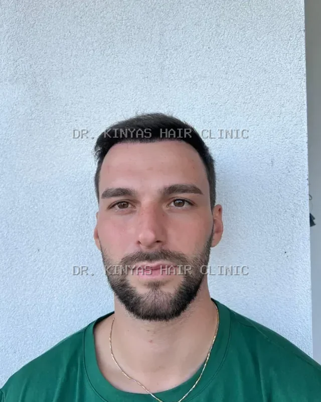 DOPO