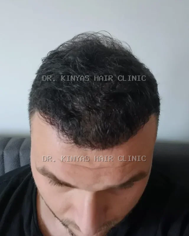 DOPO