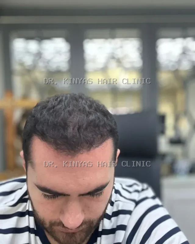 DOPO