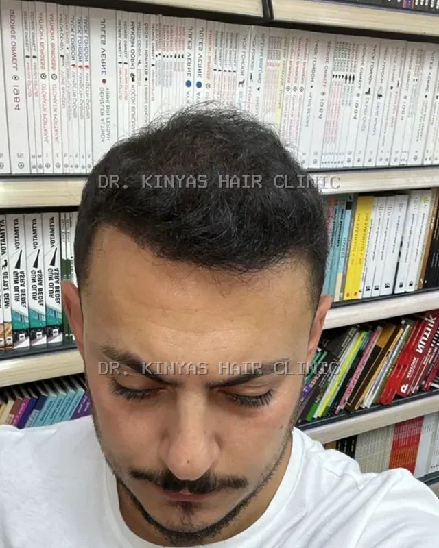 DOPO