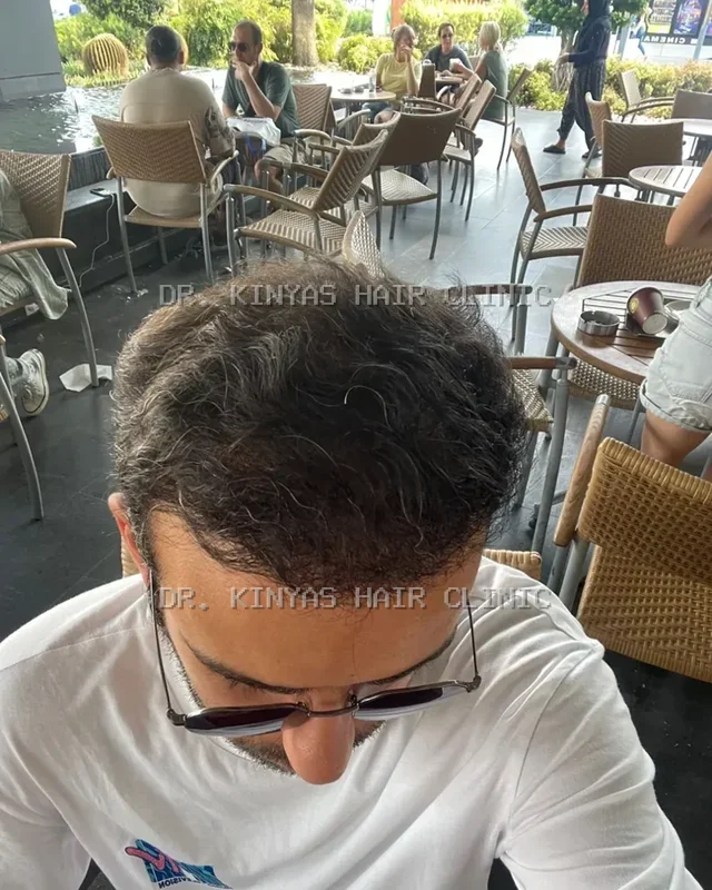 DOPO