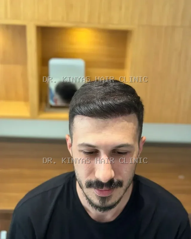 DOPO