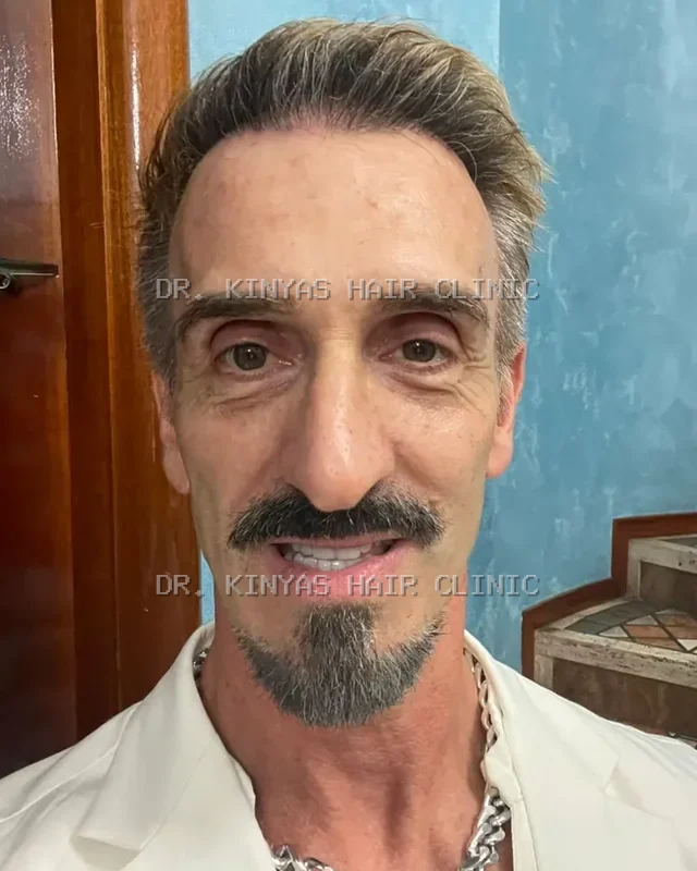 DOPO