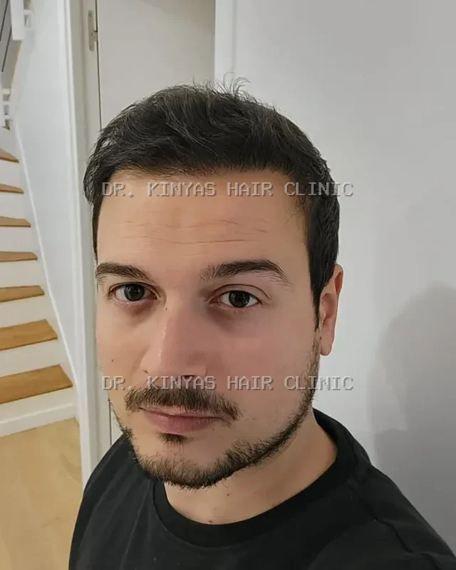 DOPO