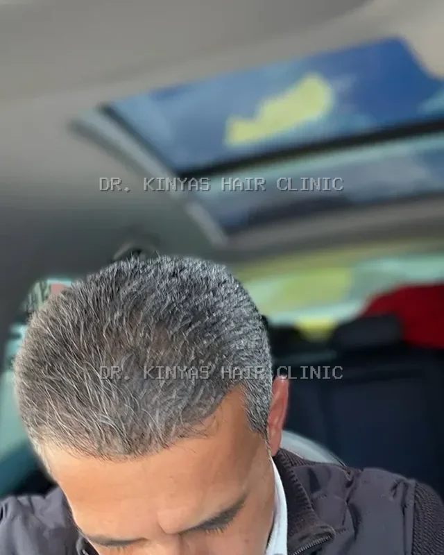 DOPO
