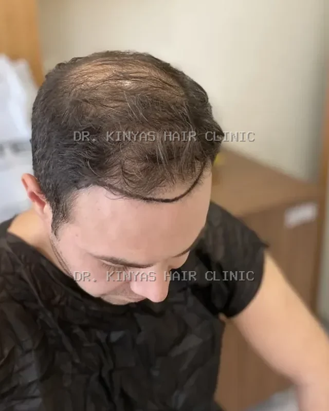 DOPO